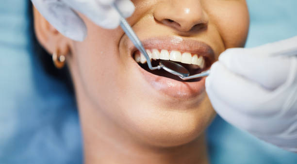 Best Emergency Denture Repair in Philipsburg, PA